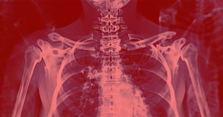 Radiography